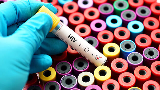 Eine behandschuhte Hand hält eines von zahlreichen bunten Teströhrchen. Darauf steht "HIV". Ein kleines Feld mit einem "+ Symbol" ist angekreuzt.