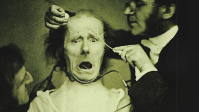 historische Foto zeigt ein Experiment zur Darstellung menschlicher Emotionen durch elektrische Stimulation der Gesichtsmuskeln